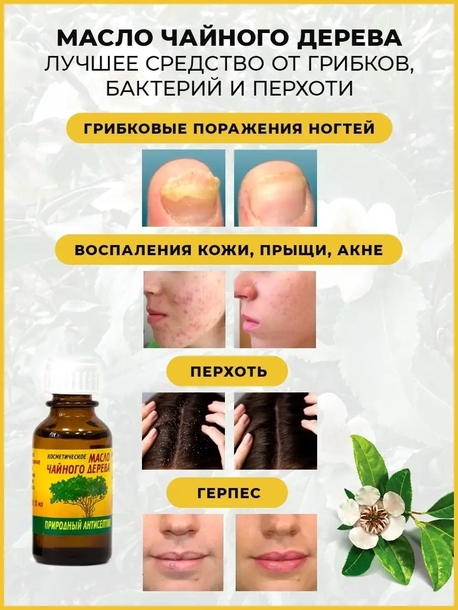 Масло чайного дерева эфирное для ногтей Elfarma купить по цене 0 р. в  интернет-магазине Wildberries в Беларуси | 43413729