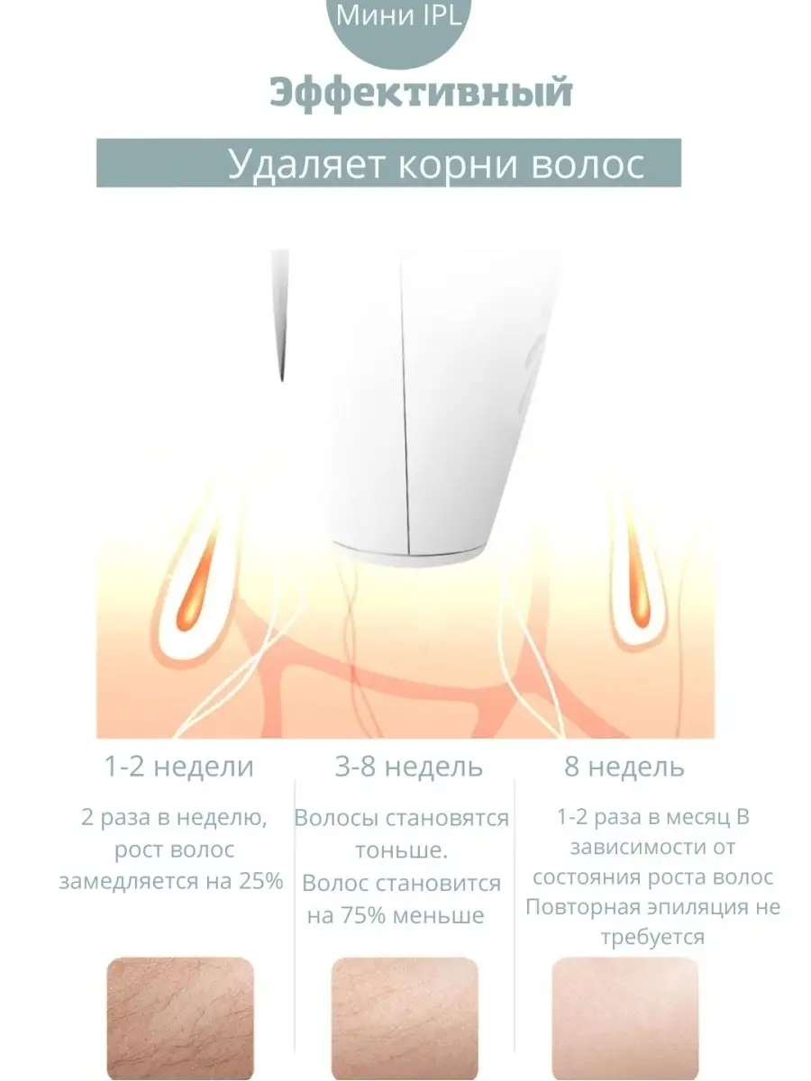 Лазерный эпилятор Фотоэпилятор BeautyB купить по цене 1 497 ₽ в  интернет-магазине Wildberries | 48691400