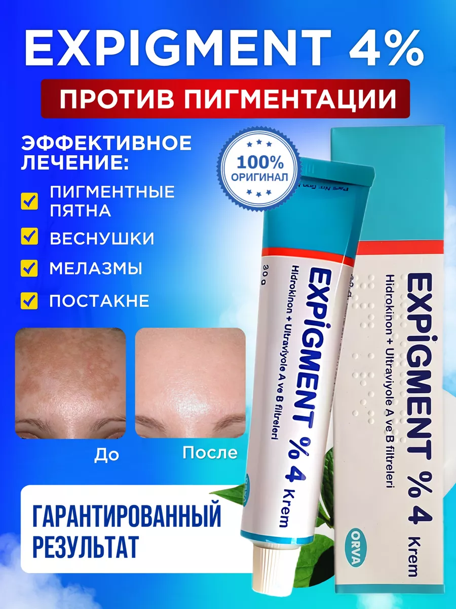 Крем против пигментных пятен и веснушек Expigment 4% ORVA купить по цене  481 ₽ в интернет-магазине Wildberries | 56286211