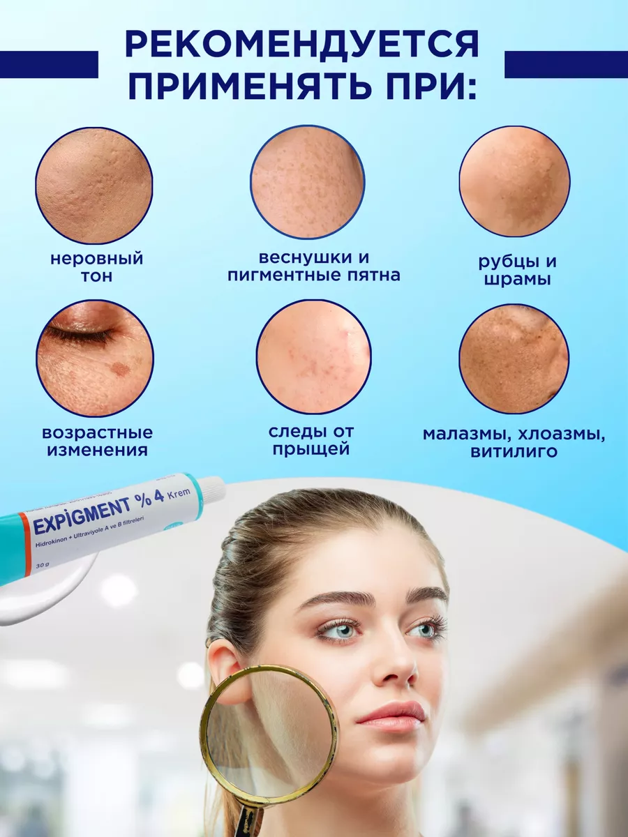 Крем против пигментных пятен и веснушек Expigment 4% ORVA купить по цене  481 ₽ в интернет-магазине Wildberries | 56286211