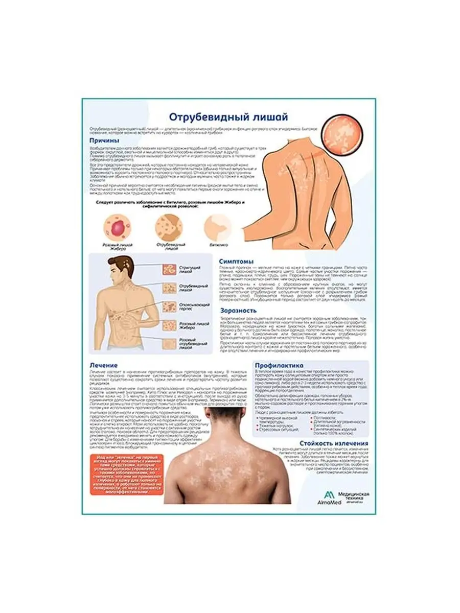 Отрубевидный лишай медицинский плакат Плакаты купить по цене 836 ₽ в  интернет-магазине Wildberries | 62925663