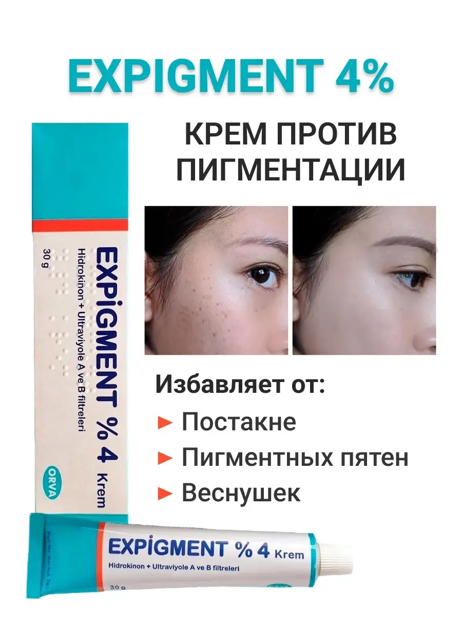 Отбеливающий крем Expigment 4% от пигментных пятен с гидрохи… ORVA купить  по цене 430 ₽ в интернет-магазине Wildberries | 69305373